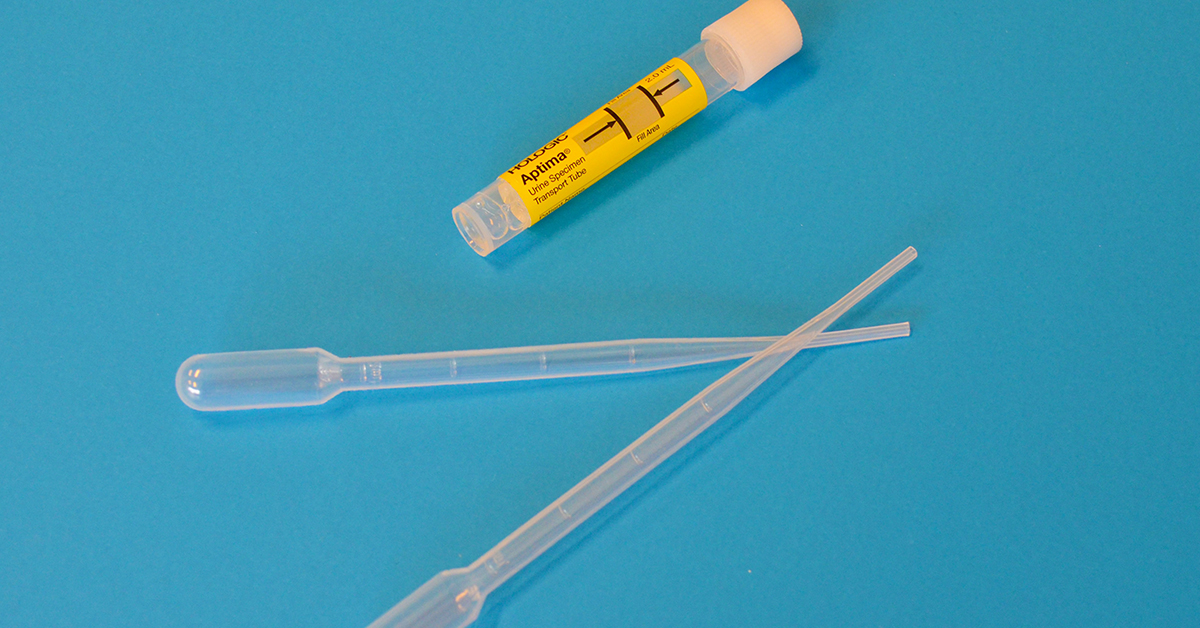 urin-ketose-test
