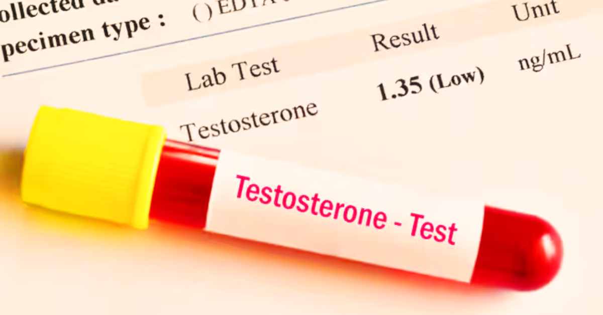 testosteron-level-messen