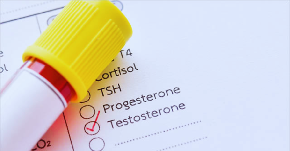 testosteron-testen-lassen